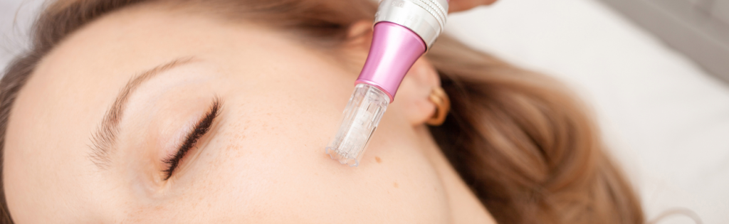 Top 7 Benefits of Microneedling You Didn’t Know About