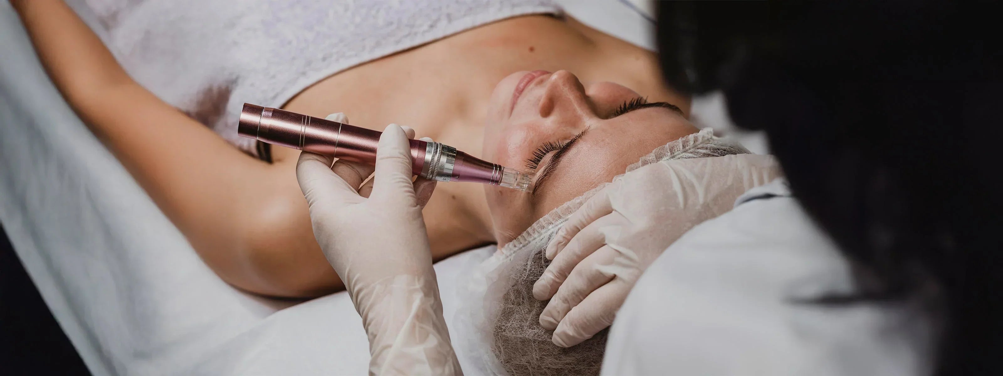 Microneedling at Home vs. Professional Treatments: What You Need to Know