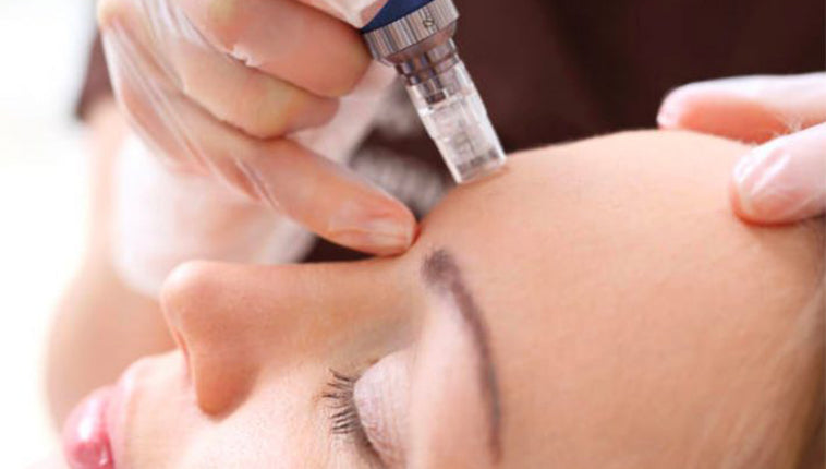 Microneedling Aftercare: Do’s and Don’ts for Glowing Skin