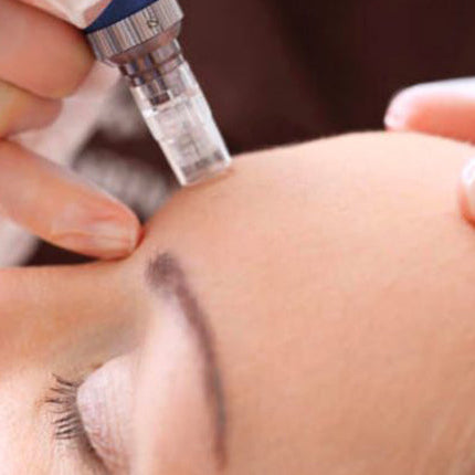 Dr. Pen M8S Microneedling Pen – Professional Derma Pen for Skin Rejuvenation & Anti-Aging